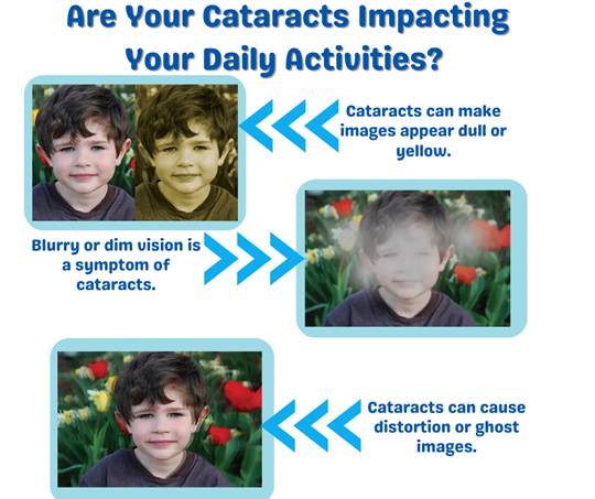 are your cataracts impacting your daily activities?