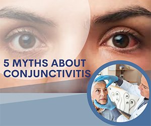 5 Myths about conjunctivitis